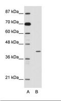 HMBOX1 Antibody - A: Marker, B: Jurkat Cell Lysate.  This image was taken for the unconjugated form of this product. Other forms have not been tested.