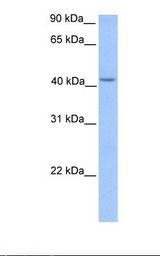 HMBS / PBGD Antibody - Fetal liver lysate. Antibody concentration: 1.0 ug/ml. Gel concentration: 12%.  This image was taken for the unconjugated form of this product. Other forms have not been tested.