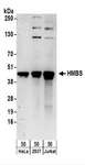 HMBS / PBGD Antibody - Detection of Human HMBS by Western Blot. Samples: Whole cell lysate (50 ug) from HeLa, 293T, and Jurkat cells. Antibodies: Affinity purified rabbit anti-HMBS antibody used for WB at 0.1 ug/ml. Detection: Chemiluminescence with an exposure time of 3 minutes.