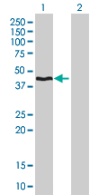 HMBS / PBGD Antibody - Western Blot analysis of HMBS expression in transfected 293T cell line by HMBS monoclonal antibody (M01), clone 3E8.Lane 1: HMBS transfected lysate(39.71 KDa).Lane 2: Non-transfected lysate.