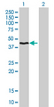 HMBS / PBGD Antibody - Western Blot analysis of HMBS expression in transfected 293T cell line by HMBS monoclonal antibody (M01), clone 3E8.Lane 1: HMBS transfected lysate(39.71 KDa).Lane 2: Non-transfected lysate.