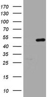HMBS / PBGD Antibody - HEK293T cells were transfected with the pCMV6-ENTRY control (Left lane) or pCMV6-ENTRY HMBS (Right lane) cDNA for 48 hrs and lysed. Equivalent amounts of cell lysates (5 ug per lane) were separated by SDS-PAGE and immunoblotted with anti-HMBS.