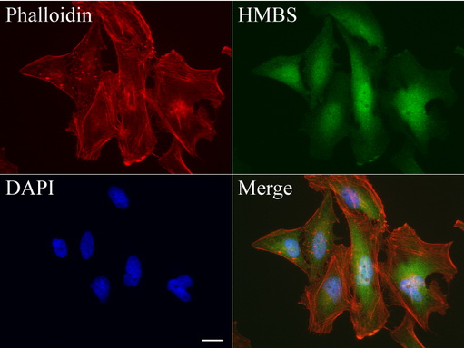 HMBS / PBGD Antibody - Immunofluorescent staining of HeLa cells using anti-HMBS mouse monoclonal antibody  green, 1:50). Actin filaments were labeled with Alexa Fluor® 594 Phalloidin. (red), and nuclear with DAPI. (blue). Scale bar, 20µm.