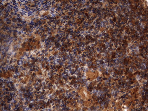 HMBS / PBGD Antibody - Immunohistochemical staining of paraffin-embedded Human lymph node tissue using anti-HMBS mouse monoclonal antibody.  heat-induced epitope retrieval by 10mM citric buffer, pH9.0, 120C for 3min)