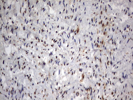 HMBS / PBGD Antibody - Immunohistochemical staining of paraffin-embedded Human muscle tissue using anti-HMBS mouse monoclonal antibody.  heat-induced epitope retrieval by 10mM citric buffer, pH9.0, 120C for 3min)