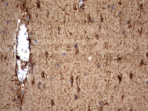 HMBS / PBGD Antibody - Immunohistochemical staining of paraffin-embedded Human embryonic brain cortex tissue using anti-HMBS mouse monoclonal antibody.  heat-induced epitope retrieval by 10mM citric buffer, pH9.0, 120C for 3min)