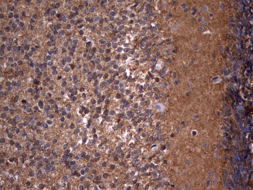 HMBS / PBGD Antibody - Immunohistochemical staining of paraffin-embedded Human embryonic cerebellum using anti-HMBSmouse monoclonal antibody.  heat-induced epitope retrieval by 10mM citric buffer, pH9.0, 120C for 3min)