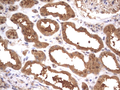 HMBS / PBGD Antibody - Immunohistochemical staining of paraffin-embedded Human Kidney tissue using anti-HMBS mouse monoclonal antibody.  heat-induced epitope retrieval by 10mM citric buffer, pH9.0, 120C for 3min)