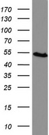 HMBS / PBGD Antibody - Western blot analysis of KM12 cell lysate. (35ug) by using anti-HMBS monoclonal antibody.