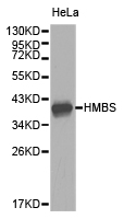 HMBS / PBGD Antibody - Western blot of extracts of HeLa cell lines, using HMBS antibody.