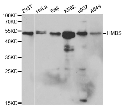 HMBS / PBGD Antibody - Western blot analysis of extracts of various cell lines.