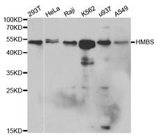 HMBS / PBGD Antibody - Western blot analysis of extracts of various cell lines.