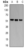 HMBS / PBGD Antibody - Western blot analysis of PBGD expression in HeLa (A); Raji (B); K562 (C) whole cell lysates.
