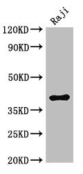 HMBS / PBGD Antibody - Positive WB detected in:Raji whole cell lysate;All lanes:HMBS antibody at 3?g/ml;Secondary;Goat polyclonal to rabbit IgG at 1/50000 dilution;Predicted band size: 40,38,35,34 KDa;Observed band size: 40 KDa;