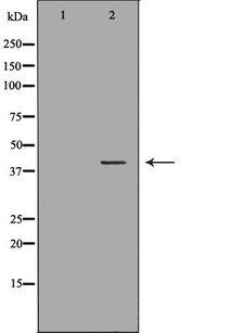 HMBS / PBGD Antibody - Western blot analysis of HeLa whole cells lysates using HMBS antibody. The lane on the left is treated with the antigen-specific peptide.