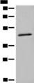 HMBS / PBGD Antibody - Western blot analysis of K562 cell lysate  using HMBS Polyclonal Antibody at dilution of 1:450
