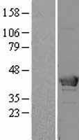 HMBS / PBGD Protein - Western validation with an anti-DDK antibody * L: Control HEK293 lysate R: Over-expression lysate