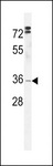 HMCES / C3orf37 Antibody - DC12 Antibody western blot of HL-60 cell line lysates (35 ug/lane). The DC12 antibody detected the DC12 protein (arrow).