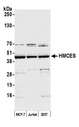 HMCES / C3orf37 Antibody - Detection of human HMCES by western blot. Samples: Whole cell lysate (50 µg) from MCF-7, Jurkat, and HEK293T cells prepared using NETN lysis buffer. Antibody: Affinity purified Rabbit anti-HMCES antibody used for WB at 1:1000. Detection: Chemiluminescence with an exposure time of 30 seconds.