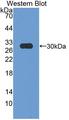 HMG-CoA Reductase / HMGCR Antibody - Western blot of HMG-CoA Reductase / HMGCR antibody.