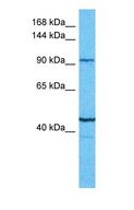 HMG-CoA Reductase / HMGCR Antibody - Western blot of HMDH Antibody with human MCF7 Whole Cell lysate.  This image was taken for the unconjugated form of this product. Other forms have not been tested.