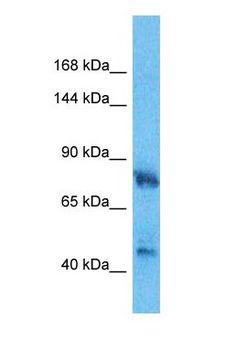 HMG-CoA Reductase / HMGCR Antibody - Western blot of HMGCR Antibody with human Fetal Lung lysate.  This image was taken for the unconjugated form of this product. Other forms have not been tested.