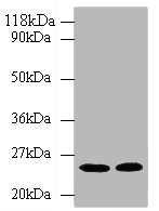 HMG-CoA Reductase / HMGCR Antibody - Western blot All lanes: 3-hydroxy-3 methylglutaryl-coenzyme A reductase antibody at 2µg/ml Lane 1: Hela whole cell lysate Lane 2: 293T whole cell lysate Secondary Goat polyclonal to rabbit IgG at 1/10000 dilution Predicted band size: 98, 93, 100 kDa Observed band size: 25 kDa