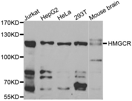 HMG-CoA Reductase / HMGCR Antibody - Western blot analysis of extracts of various cell lines, using HMGCR antibody.