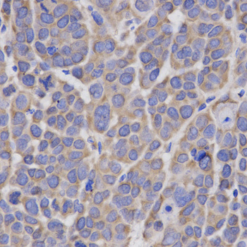 HMG-CoA Reductase / HMGCR Antibody - Immunohistochemistry of paraffin-embedded human kidney using IL23R antibody at dilution of 1:200 (x400 lens)