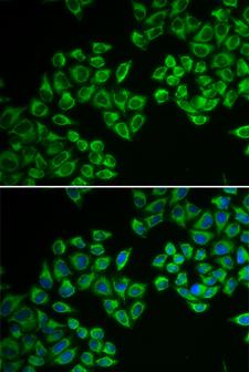 HMG-CoA Reductase / HMGCR Antibody - Immunofluorescence analysis of A549 cells.