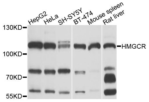 HMG-CoA Reductase / HMGCR Antibody - Western blot analysis of extracts of various cell lines, using HMGCR antibody at 1:1000 dilution. The secondary antibody used was an HRP Goat Anti-Rabbit IgG (H+L) at 1:10000 dilution. Lysates were loaded 25ug per lane and 3% nonfat dry milk in TBST was used for blocking. An ECL Kit was used for detection and the exposure time was 10s.