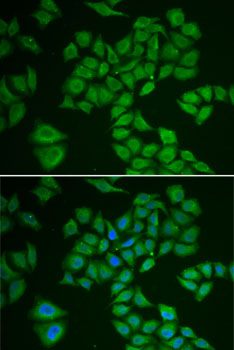 HMG-CoA Reductase / HMGCR Antibody - Immunofluorescence analysis of A-549 cells using HMGCR antibody. Blue: DAPI for nuclear staining.