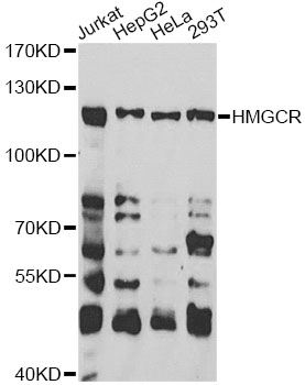HMG-CoA Reductase / HMGCR Antibody - Western blot analysis of extracts of various cell lines, using HMGCR antibody at 1:1000 dilution. The secondary antibody used was an HRP Goat Anti-Rabbit IgG (H+L) at 1:10000 dilution. Lysates were loaded 25ug per lane and 3% nonfat dry milk in TBST was used for blocking.