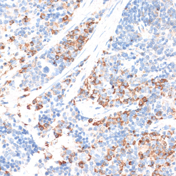 HMG-CoA Reductase / HMGCR Antibody - Immunohistochemistry of paraffin-embedded mouse spleen using HMGCR antibody at dilution of 1:100 (40x lens).