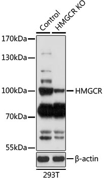 HMG-CoA Reductase / HMGCR Antibody - Western blot analysis of extracts from normal (control) and HMGCR knockout (KO) 293T cells, using HMGCR antibody at 1:1000 dilution. The secondary antibody used was an HRP Goat Anti-Rabbit IgG (H+L) at 1:10000 dilution. Lysates were loaded 25ug per lane and 3% nonfat dry milk in TBST was used for blocking. An ECL Kit was used for detection and the exposure time was 3min.