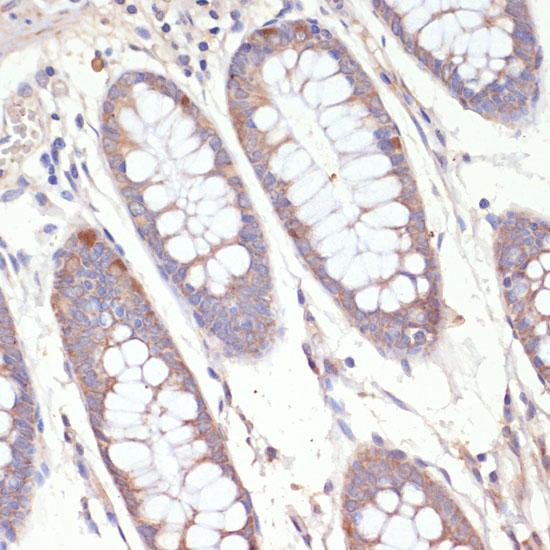 HMG-CoA Reductase / HMGCR Antibody - Immunohistochemistry of paraffin-embedded Human colon using HMGCR Polyclonal Antibody at dilution of 1:200 (40x lens).