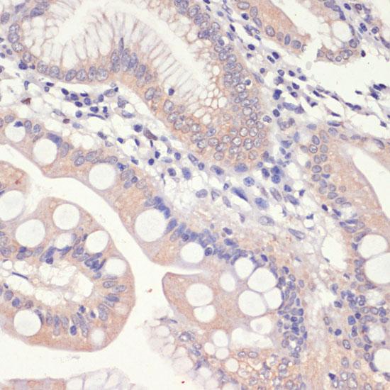 HMG-CoA Reductase / HMGCR Antibody - Immunohistochemistry of paraffin-embedded Human small intestine using HMGCR Polyclonal Antibody at dilution of 1:200 (40x lens).