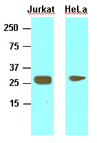HMG1 / HMGB1 Antibody - Cell lysates of Jurkat and HeLa (30 ug) were resolved by SDS-PAGE, transferred to NC membrane and probed with anti-human HMGB1 (1:1000). Proteins were visualized using a goat anti-mouse secondary antibody conjugated to HRP and an ECL detection system.