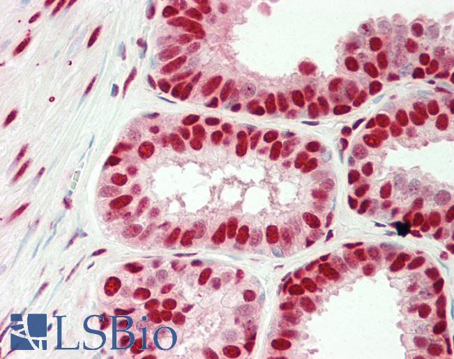 HMG1 / HMGB1 Antibody - Human Prostate: Formalin-Fixed, Paraffin-Embedded (FFPE).  This image was taken for the unconjugated form of this product. Other forms have not been tested.