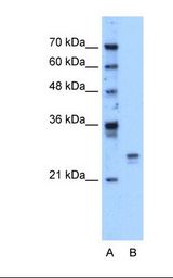 HMG1 / HMGB1 Antibody - Lane A: Marker. Lane B: HepG2 cell lysate. Antibody concentration: 1.25 ug/ml. Gel concentration: 12%.  This image was taken for the unconjugated form of this product. Other forms have not been tested.