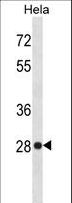 HMG1 / HMGB1 Antibody - HMGB1 Antibody western blot of HeLa cell line lysates (35 ug/lane). The HMGB1 antibody detected the HMGB1 protein (arrow).