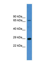 HMG1 / HMGB1 Antibody - HMGB1 antibody Western blot of 293T cell lysate. This image was taken for the unconjugated form of this product. Other forms have not been tested.