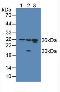 HMG1 / HMGB1 Antibody - Western Blot; Sample: Lane1: Human Hela Cells; Lane2: Human HepG2 Cells; Lane3: Human Jurkat Cells.