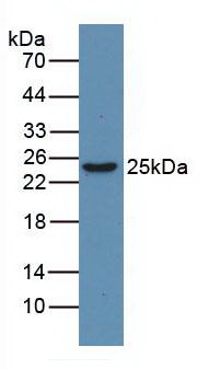 HMG1 / HMGB1 Antibody - Western Blot Human Jurkat Cells Primary Ab: 3µg/mL Rabbit Anti-Human HMG1 Ab Second Ab: 1:5000 Dilution of HRP-Linked Rabbit Anti-Mouse IgG Ab
