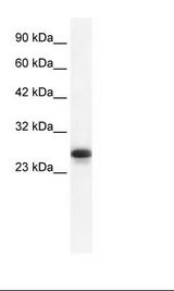 HMG1 / HMGB1 Antibody - Jurkat Cell Lysate.  This image was taken for the unconjugated form of this product. Other forms have not been tested.