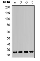 HMG1 / HMGB1 Antibody - Western blot analysis of HMGB1 expression in Jurkat (A); K562 (B); MCF7 (C); A549 (D) whole cell lysates.