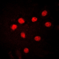 HMG1 / HMGB1 Antibody - Immunofluorescent analysis of HMGB1 staining in HUVEC cells. Formalin-fixed cells were permeabilized with 0.1% Triton X-100 in TBS for 5-10 minutes and blocked with 3% BSA-PBS for 30 minutes at room temperature. Cells were probed with the primary antibody in 3% BSA-PBS and incubated overnight at 4 deg C in a humidified chamber. Cells were washed with PBST and incubated with a DyLight 594-conjugated secondary antibody (red) in PBS at room temperature in the dark. DAPI was used to stain the cell nuclei (blue).