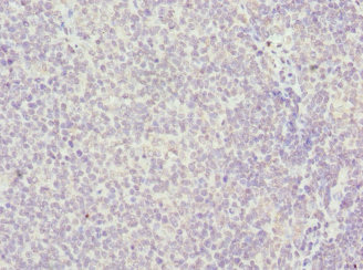 HMG1 / HMGB1 Antibody - Immunohistochemistry of paraffin-embedded human tonsil tissue using HMGB1 Antibody at dilution of 1:100