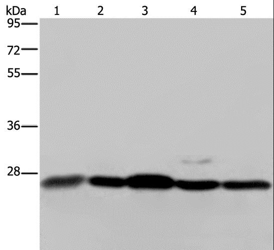 HMG1 / HMGB1 Antibody - Western blot analysis of Human hepatocellular carcinoma tissue, HeLa and Jurkat cell, 293T cell and human breast infiltrative duct tissue, using HMGB1 Polyclonal Antibody at dilution of 1:200.