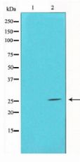 HMG1 / HMGB1 Antibody - Western blot of HMGB1 expression in HepG2 whole cell lysates,The lane on the left is treated with the antigen-specific peptide.